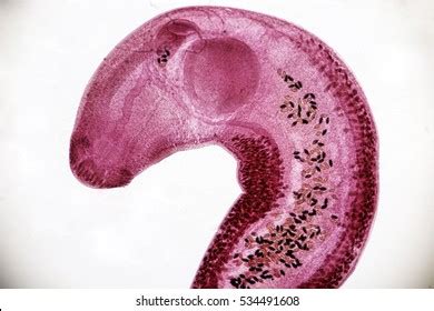  Echinostoma Rehburgi: En Parasit Med Två Hjärnor och Ett Aptit på Snäckor!