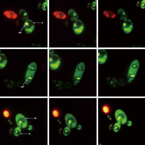  Acanthamoeba! En unik cell som kombinerar rörelse och förvandling med fascinerande precision.