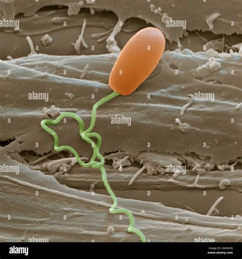  Mikrosporidium! En mikroskopisk värld av parasitiskt besynnerlighet