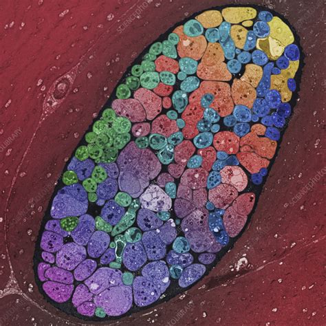 Sporozoans? Meet Sarcocystis - An Unusual Parasite That Can Turn Your Muscles Into Meatballs!